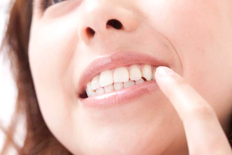 早期発見、早期治療で健康なお口を歯周病が進むと歯を失うことも。早期治療が肝心です。